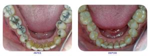 Odontologia Restauradora brunherotto